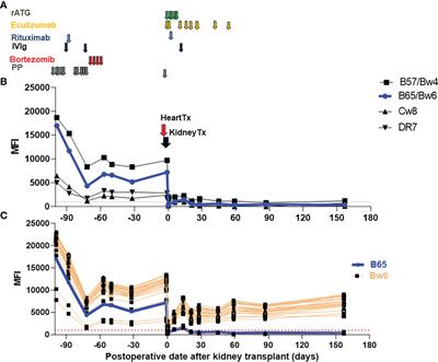 Case report: Successful simultaneous heart-kidney transplantation across a positive complement-dependent cytotoxic crossmatch